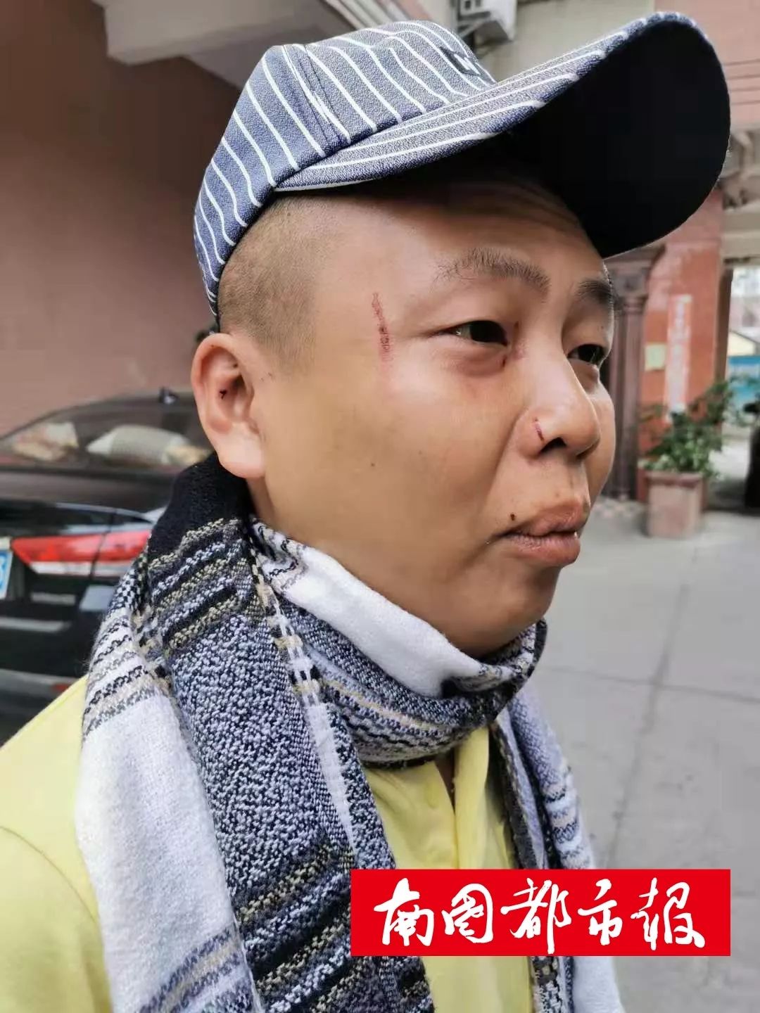 被打得满头肿包他却说幸亏打的是我