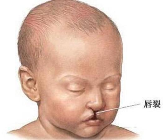 24周孕妈做四维彩超,胎宝全程"微笑"惹人爱,医生:这娃不能留