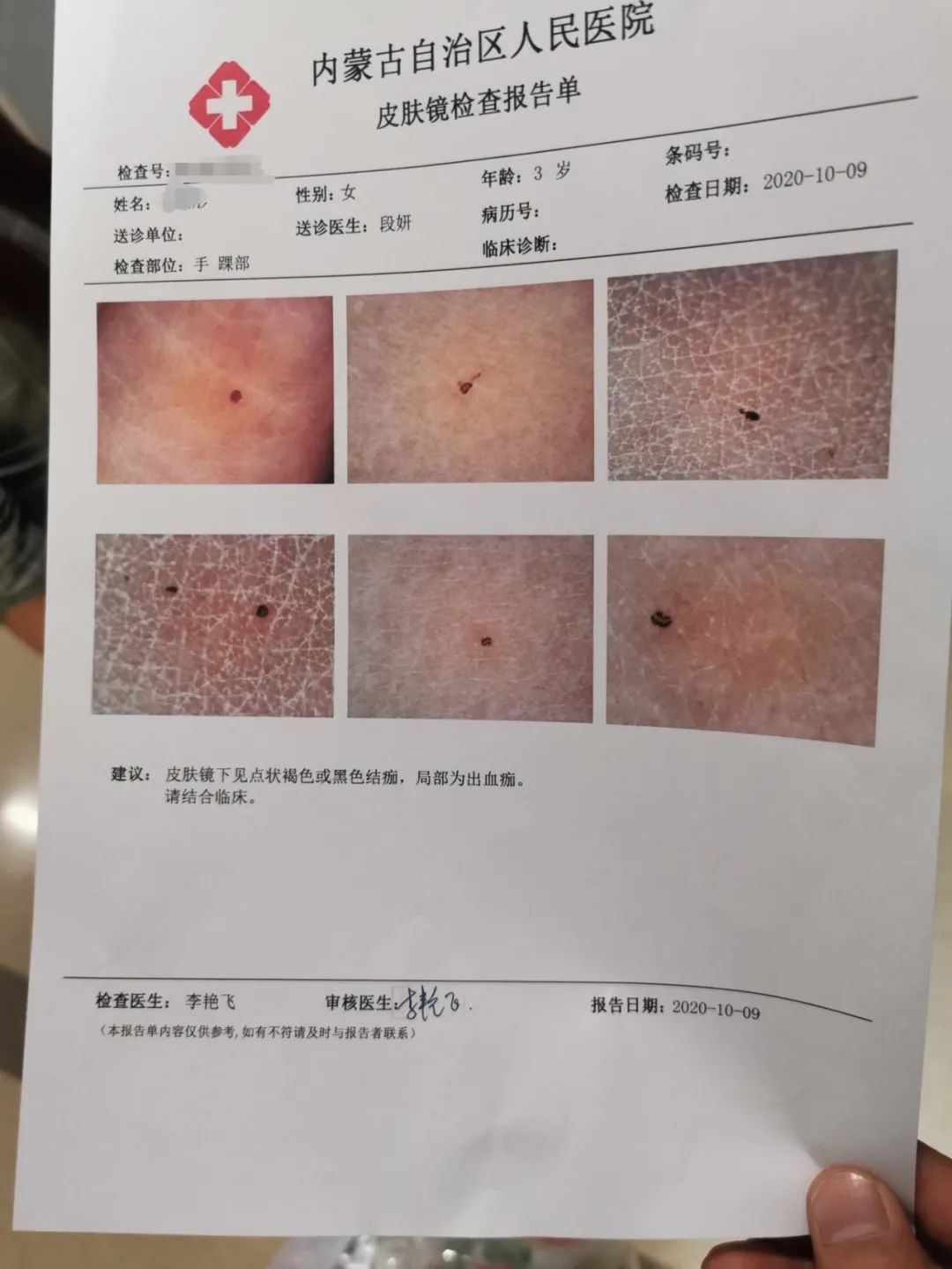 呼和浩特有幼儿被老师针扎？警方介入 涉事幼儿园春田花花已关停