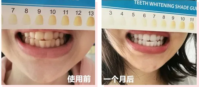 黑人肤色演化秘密 黑人为什么跑得快