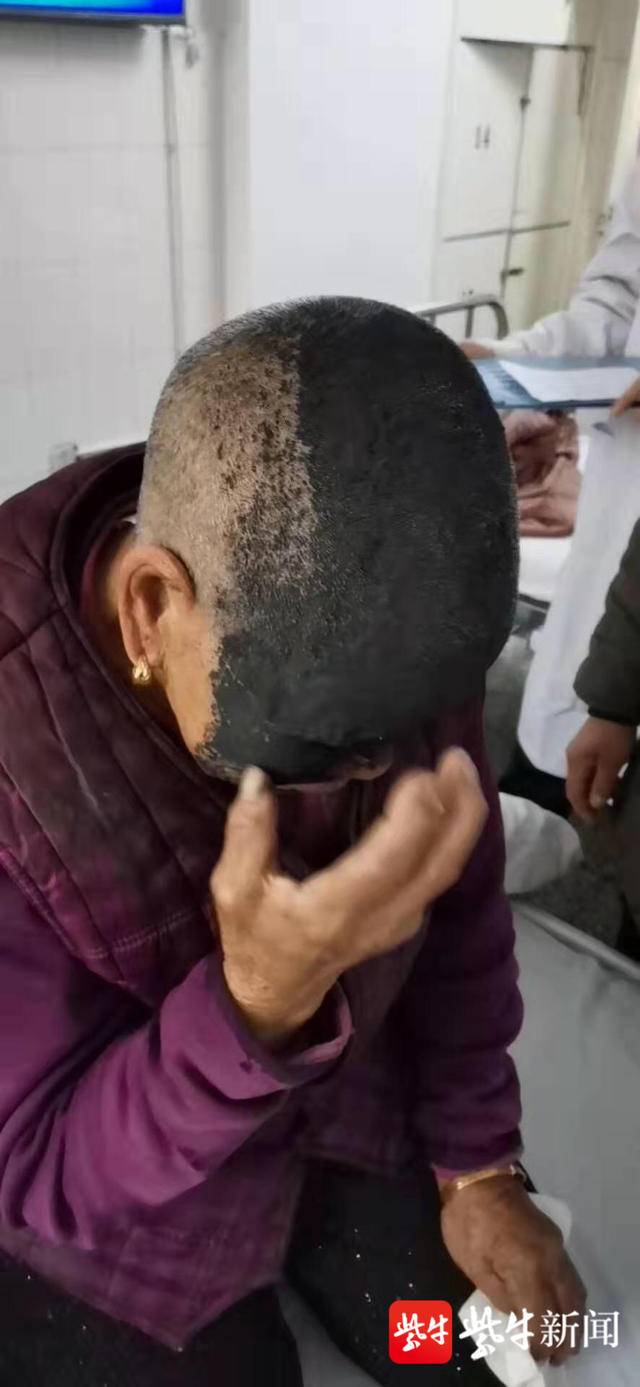 也就是人们常说的蛇胆疮,她听信了一个"土法子"在脸上涂墨汁治疗,如同