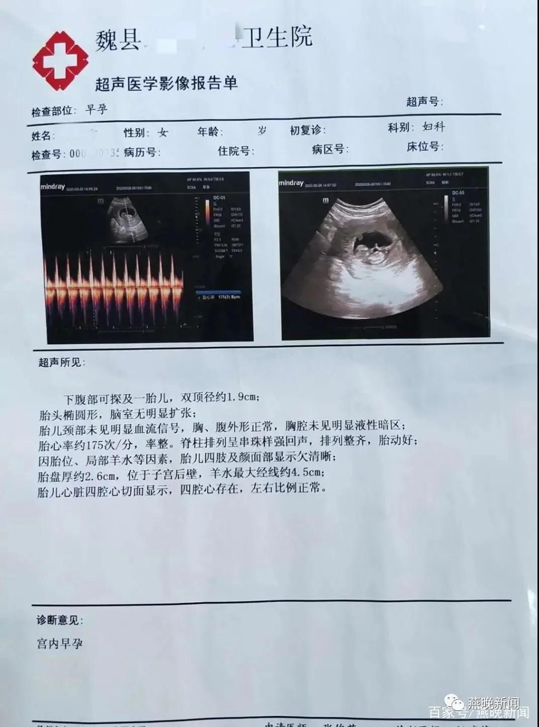 怀孕的超声检查报告单图片