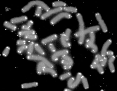 端粒（亮点）位于人类染色体（灰色）的末端（图片来源：参考资料[2]；Credit: PD-NASA; PD-USGOV-NASA）