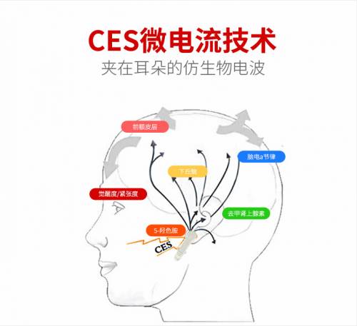 严重失眠怎么办 即眠睡眠仪给你带来充足睡眠 手机新浪网