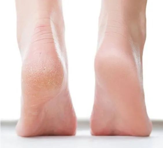 护肤秘籍武装到脚后跟儿头发丝儿居然是真的