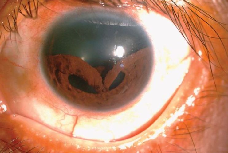 阴茎骨化,胸腔着火……2019十大奇葩病例出炉!