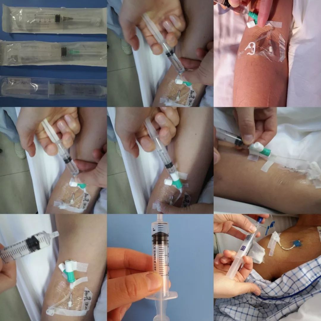 明明都封管了怎么又回血?看这 6 点你做到了吗?