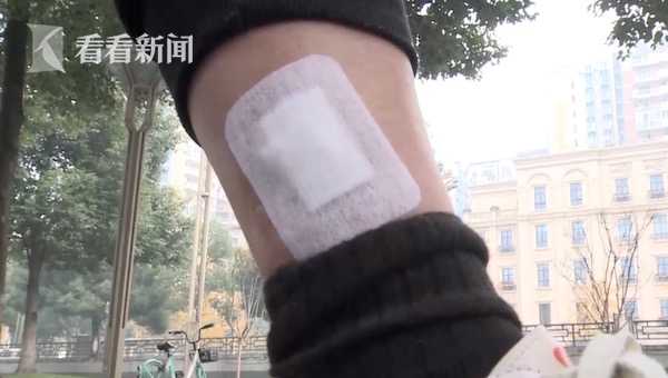 女子压穴位减肥全身埋20多根线 腿部出现血窟窿（组图） - 5
