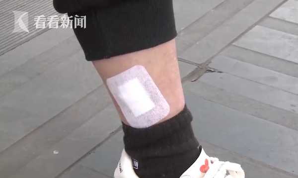 女子压穴位减肥全身埋20多根线 腿部出现血窟窿（组图） - 2