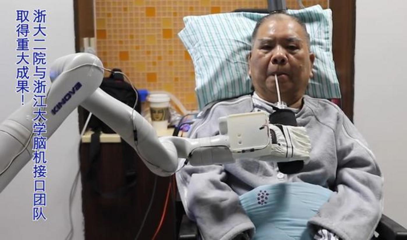 利用植入式脑机接口,72岁高位截瘫患者用意念打麻将