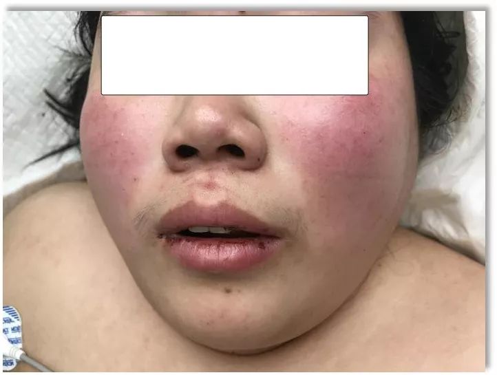 寒冬取暖,警惕这个致命"杀手"