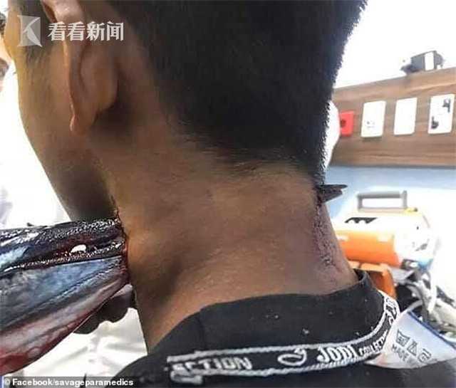 印尼少年随父母海钓 遭尖嘴针鱼跳出水扎穿脖子