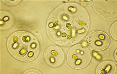 海平面以下1500米,海底黑烟囱周围,生活着一种古老的光合细菌, 它能否