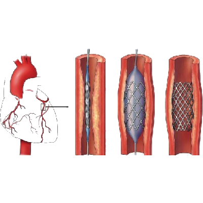 "瑞科reconnect——划时代的可再生人工血管"项目致力于研制新型可