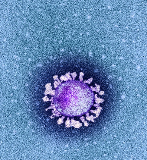 新冠病毒电镜图图片