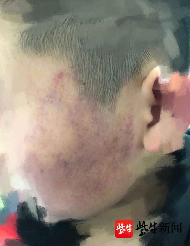 老师殴打学生被调离岗位,几十名家长联名请求老师"回归",校长拒绝回应