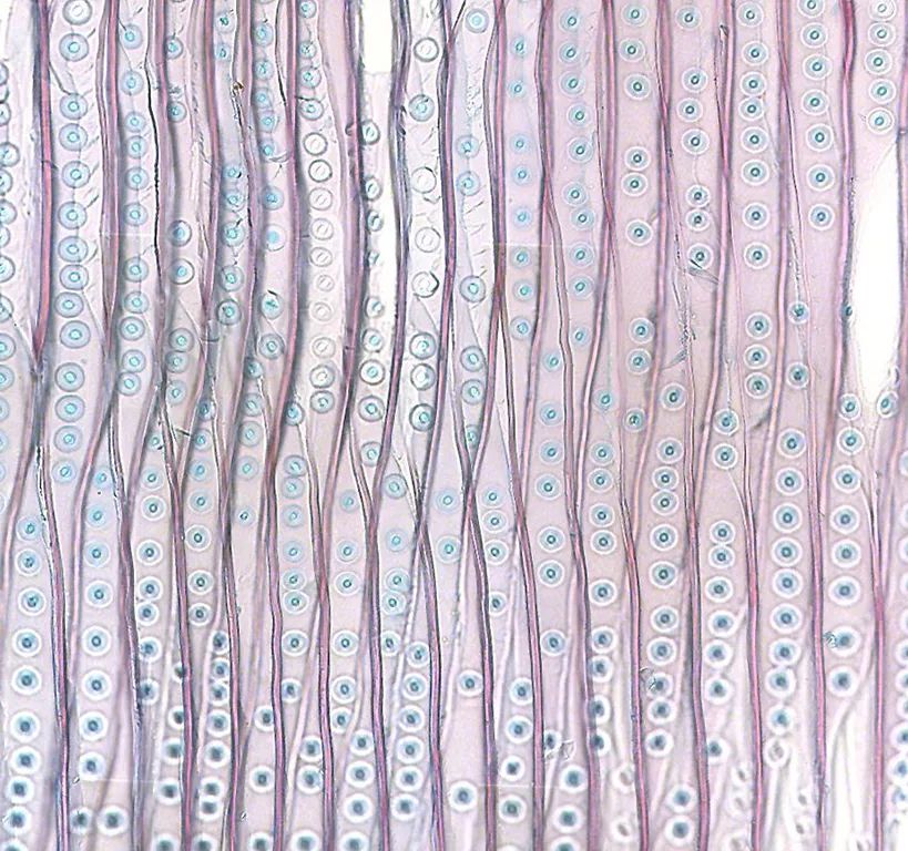 但有少量的被子植物——如昆栏树和水青树,非常意外地只有管胞,没有