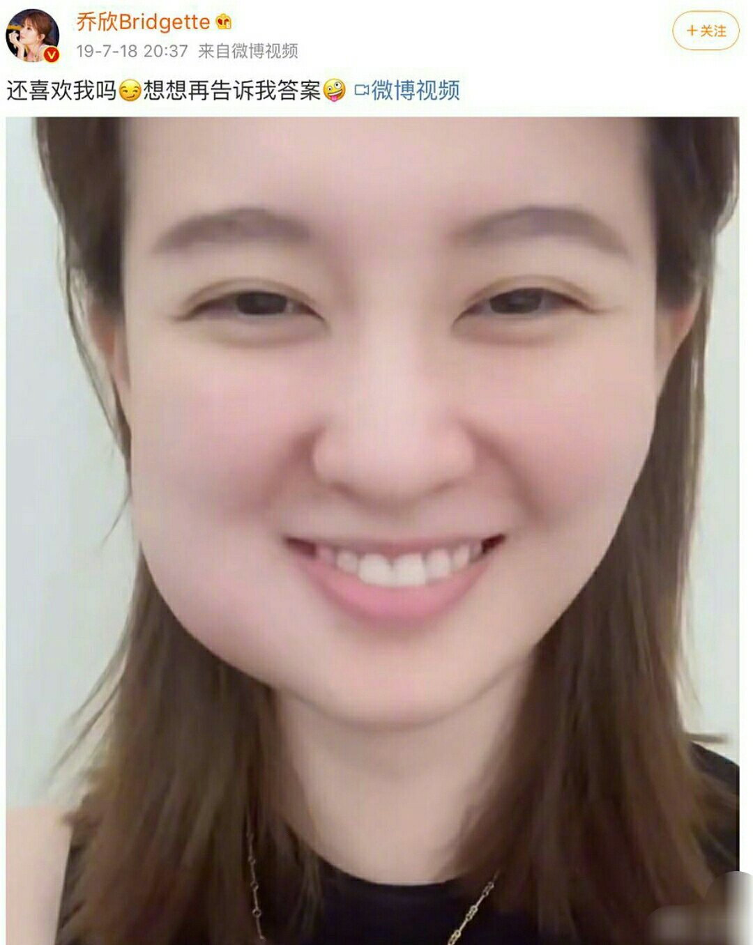 周冬雨,乔欣,刘宪华拔完智齿脸肿到认不出,是去的一家医院吗