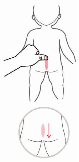 小儿便秘腹泻推七节骨