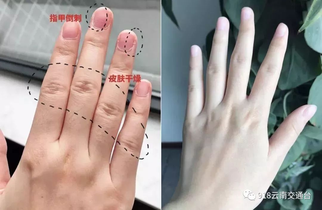 女人一伸手,就知道你有没有福气,有福的手长这样