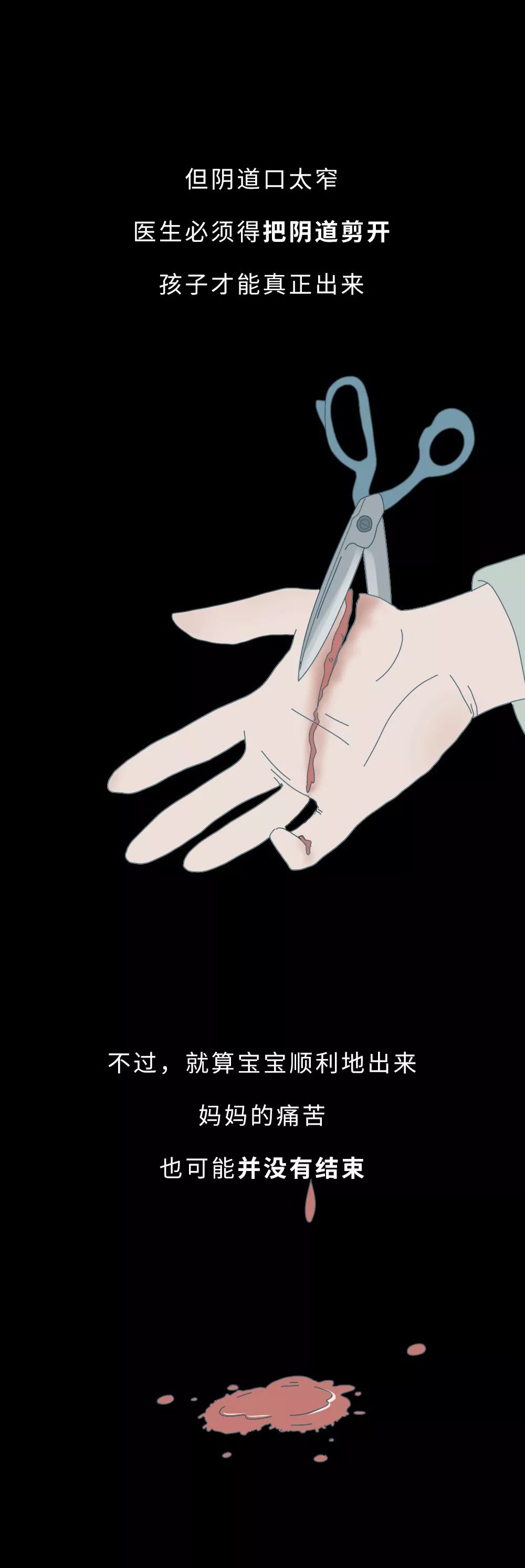 几张图告诉你生孩子"开十指"是怎么开的,没人能笑着看完