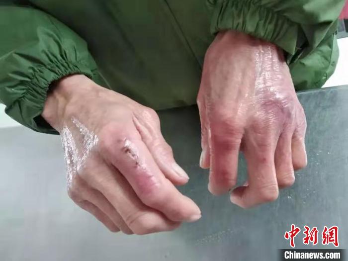 冬天厨房工作被冻伤（冬天厨房里热气腾腾热气总是聚集在什么地方） 冬天厨房工作被冻伤（冬天厨房里热气腾腾热气总是聚集在什么地方） 厨房资讯