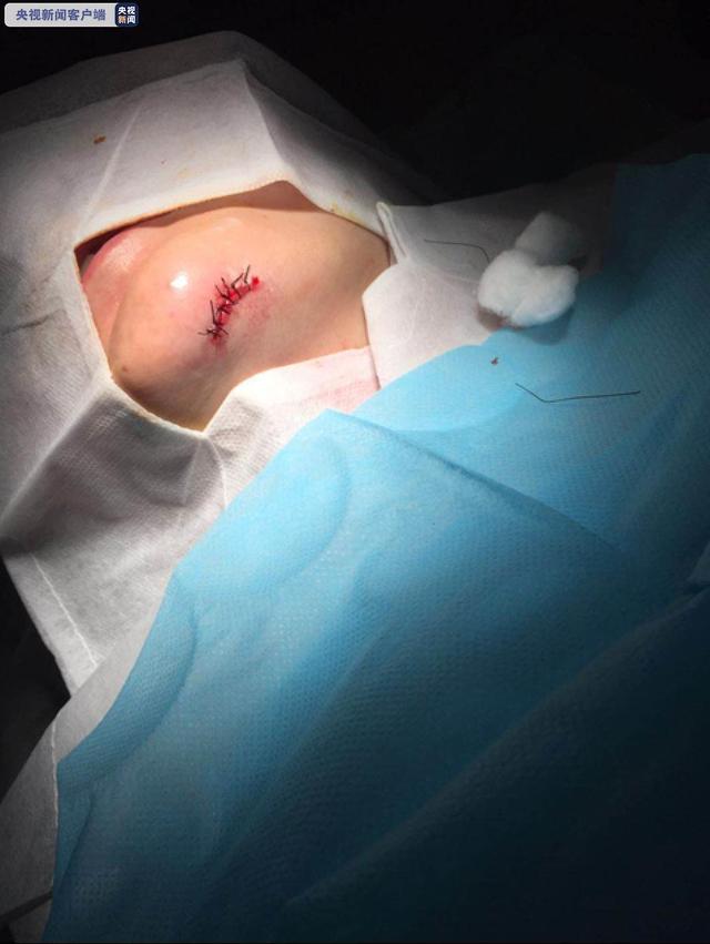 上战场,妈妈依然跟大家一起认真练习,每一步都不能落下,一旦伤口养好