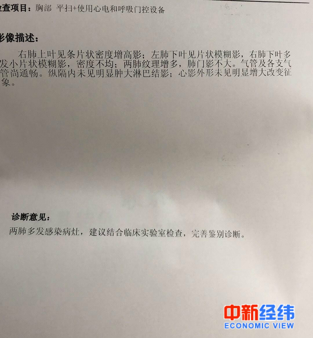 田晓薇ct检查结果 来源:受访者供图