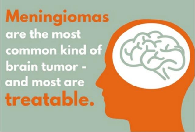 脑膜瘤不是"死神",及时手术有望治愈