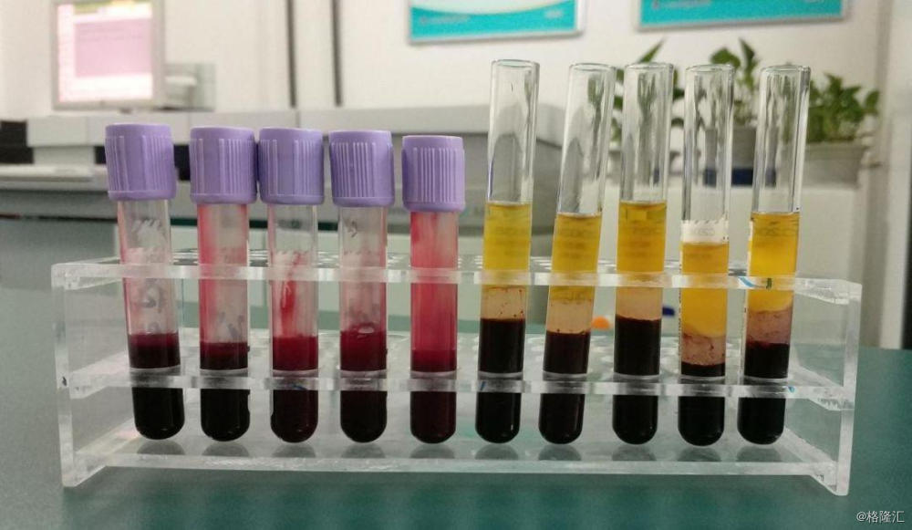 相关规定,全血献血者每次可献全血 400ml,或者 300ml,或者 200ml