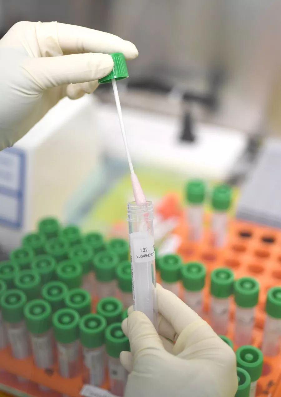 一滴血15分钟出结果钟南山指导研制试剂盒有望快速检测新冠肺炎