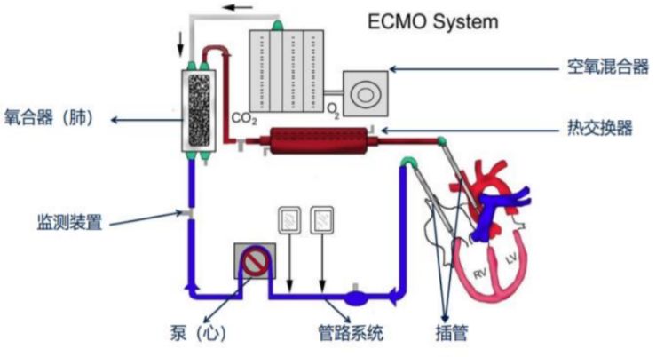 ecmo原理图解图片