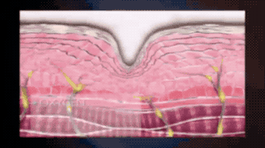 活性成分进入皮肤后的效果示意图