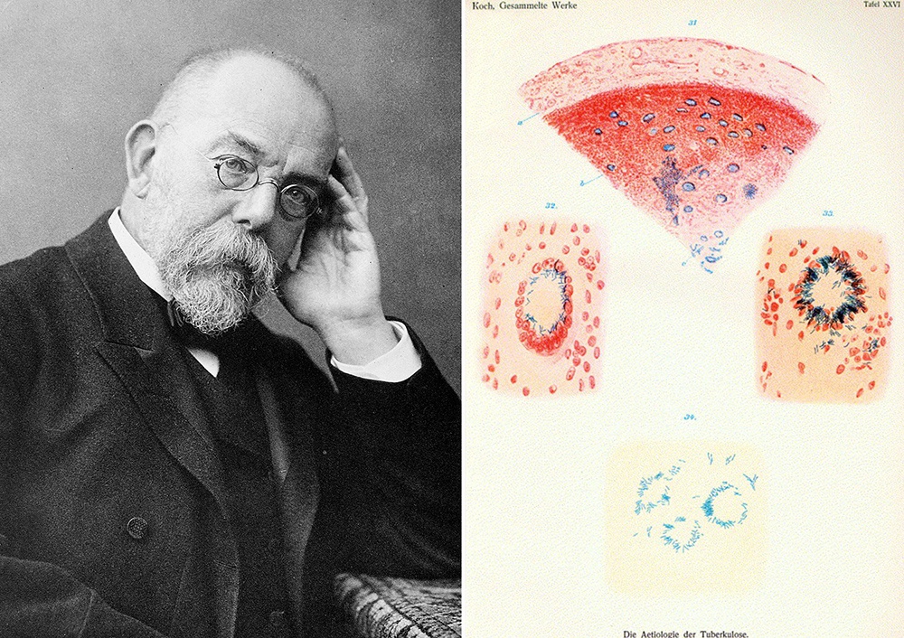 图一：德国微生物学家罗伯特·科赫与结核杆菌，1900