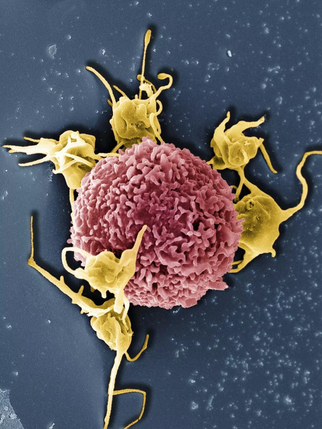 假如病毒感染了你...|病毒感染|粒细胞|新冠肺炎_新浪新闻