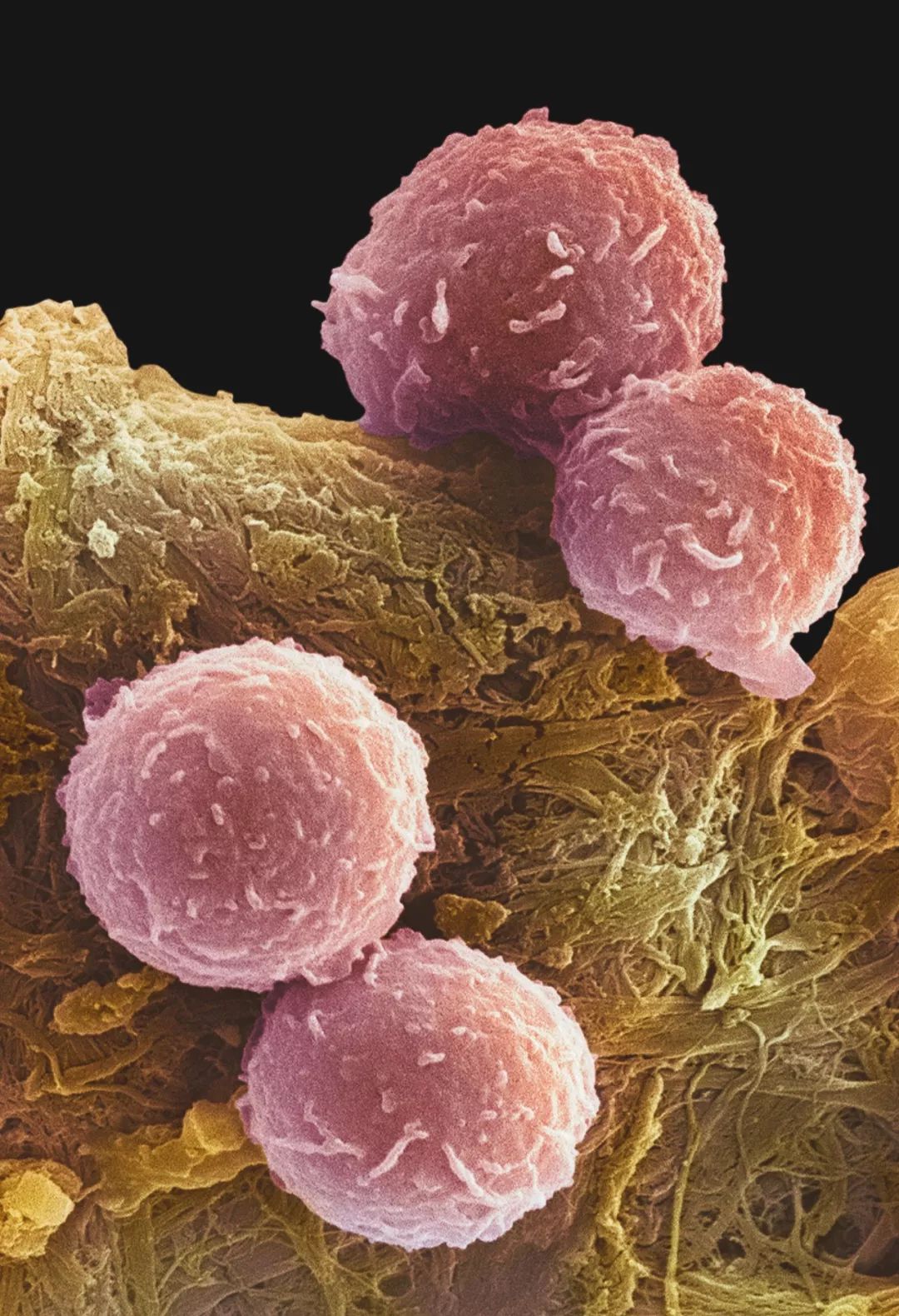 正文  这时候就需要第二特种部队   b细胞   出场了   它因在骨髓