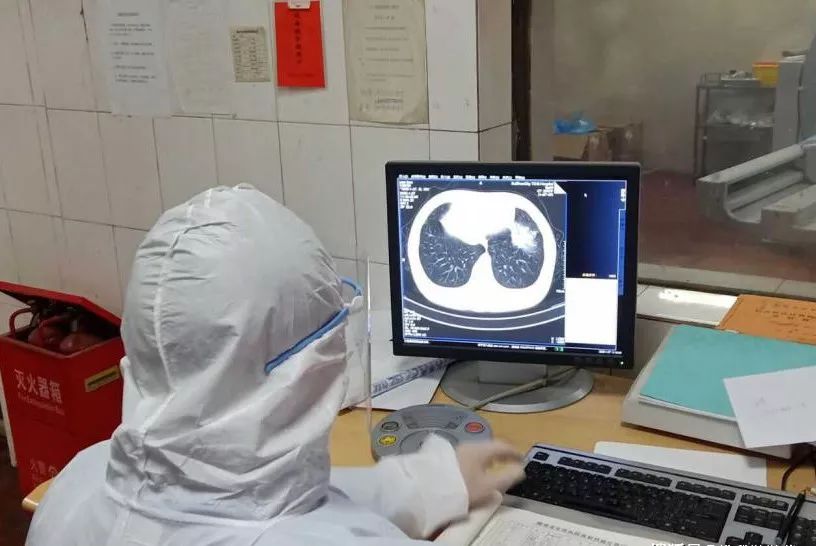 · 医生查看新冠肺炎患者CT图像。