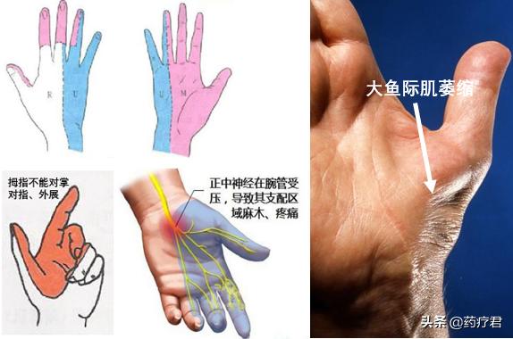 经常半夜手麻醒的你,一定是家里最勤快的人