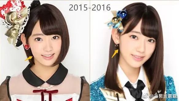 整容|鼻子|樱花_新浪新闻