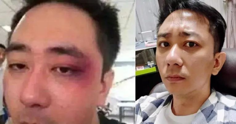 被老婆家暴的王自健太惨了