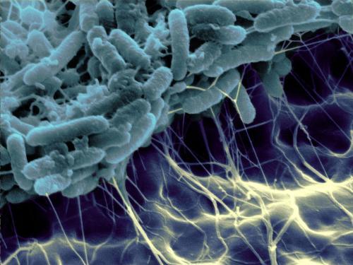 脂溢性皮炎可以使用蓝润什么产品？