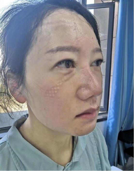 环球时报记者专访湖北医疗队队员刘丽听说我们是解放军的医生她松了