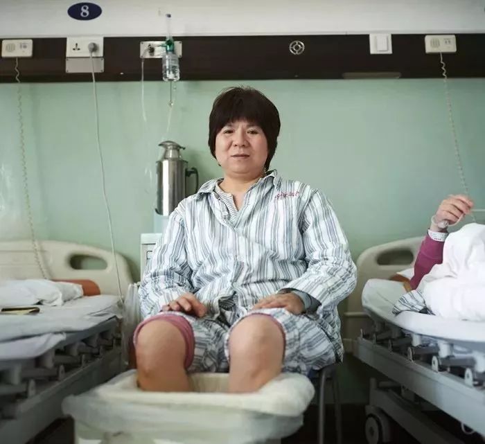 非典已过去十七年那些活着的后遗症患者组图