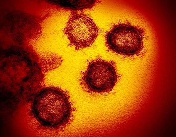 暗黑色圆形物的为新冠病毒。