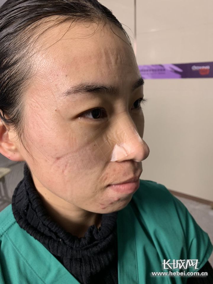 2月7日守望相助,抗击疫情我们支援的是武汉洪山体育馆方舱医院,在护理