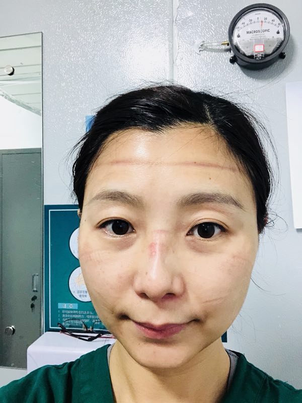 军队支援湖北医疗队队员李傲梅夫妻抗疫记