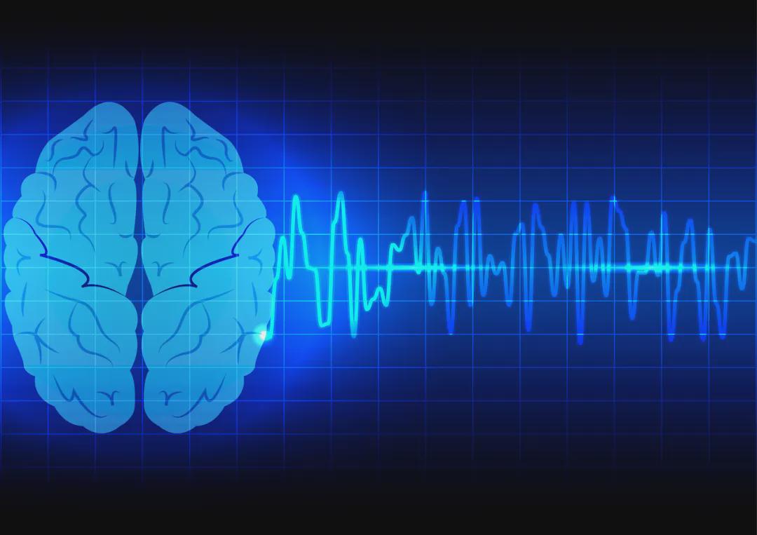 脑机接口研究新进展,"脑活动翻译机"错误率不到3%|海外头条