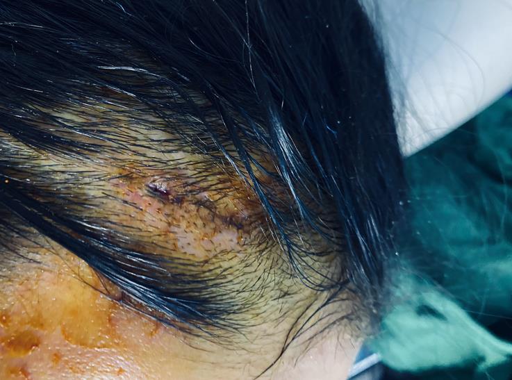 央视|上海警方打击非法医美 涉案金额超六千万元