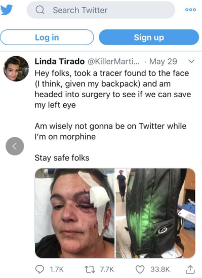 △摄影记者琳达·蒂拉多左眼被警察的橡皮子弹击中，导致永久性失明。