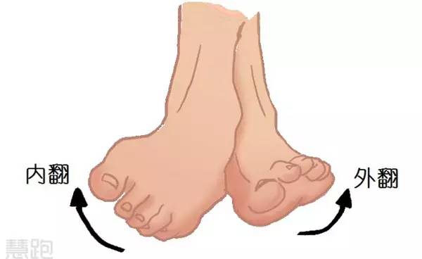 困扰我多年的跟腱病是如何康复的?